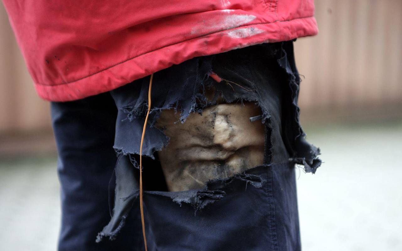 Explosion eines Böllers in der Hosentasche einer Puppe